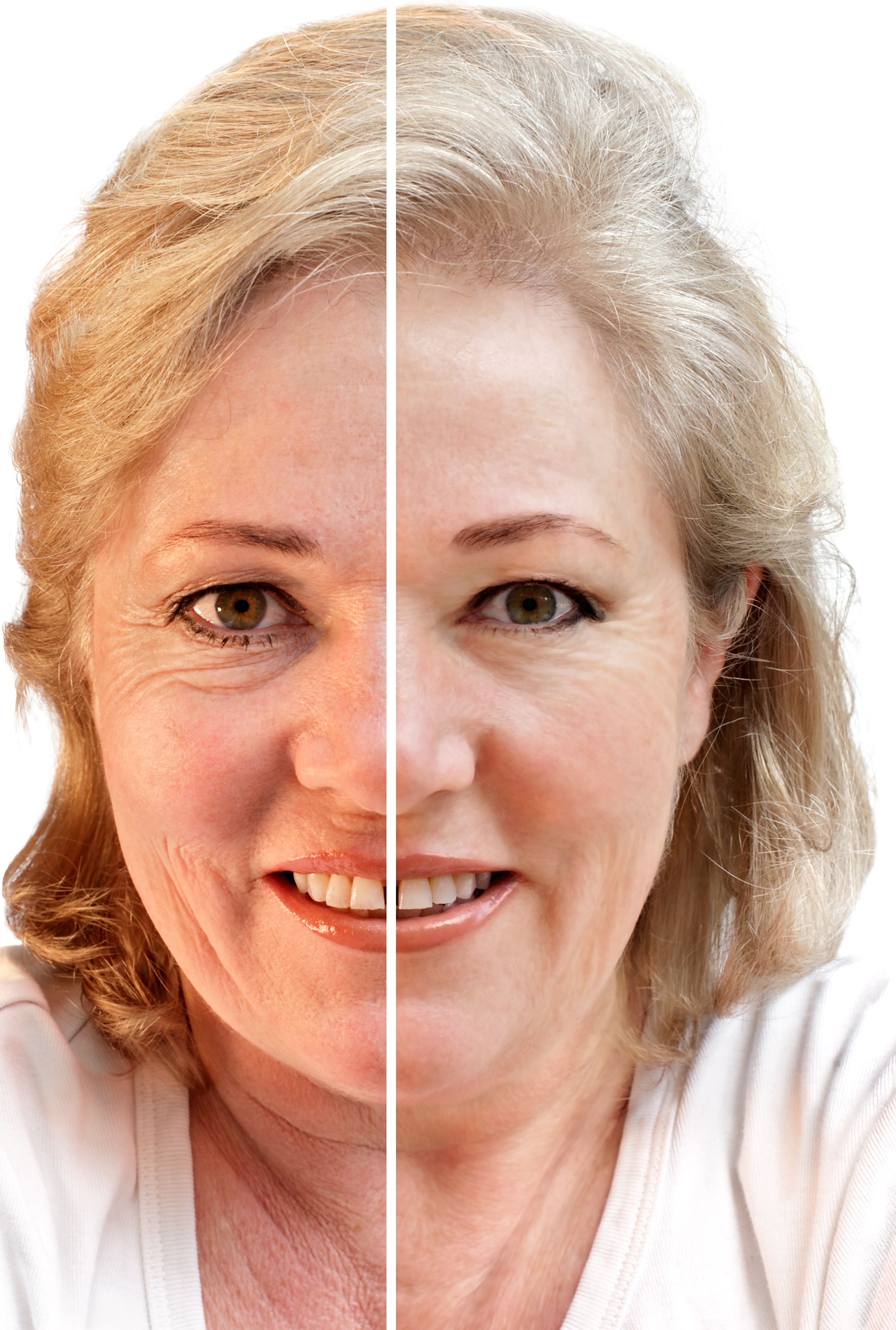 Transform Your Skin With Face Laser Treatment in Omaha, NE for Lasting Confidence
