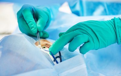 Achieve a Refreshed Look With Eyelid Surgery West Bloomfield MI Patients Trust Most