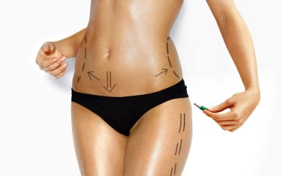 Body Contouring Surgery Dothan, AL: Explained Benefits and Recovery for Lasting Results