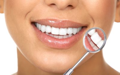 The Real Benefits of Choosing Teeth Whitening in Vista, CA for a Whiter Smile