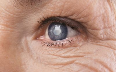 Restore Eye Comfort Fast with Advanced Dry Eye Treatment in Charlottesville, VA Clinics Offer