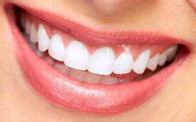Achieve Natural Results from a Trusted Cosmetic Dentist in Wilber NE