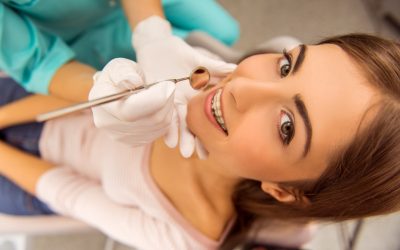Achieve a Confident Smile with Clear Braces in Fort Lauderdale, FL Orthodontic Solutions